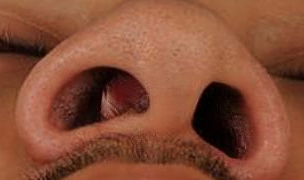Hale Breathing