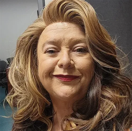 Shiny Smile Veneers